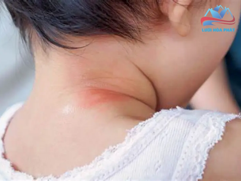 xịt muỗi cho bé