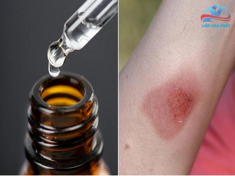 Sử dụng tinh dầu quế để bôi ngoài da (Cảnh báo an toàn)
