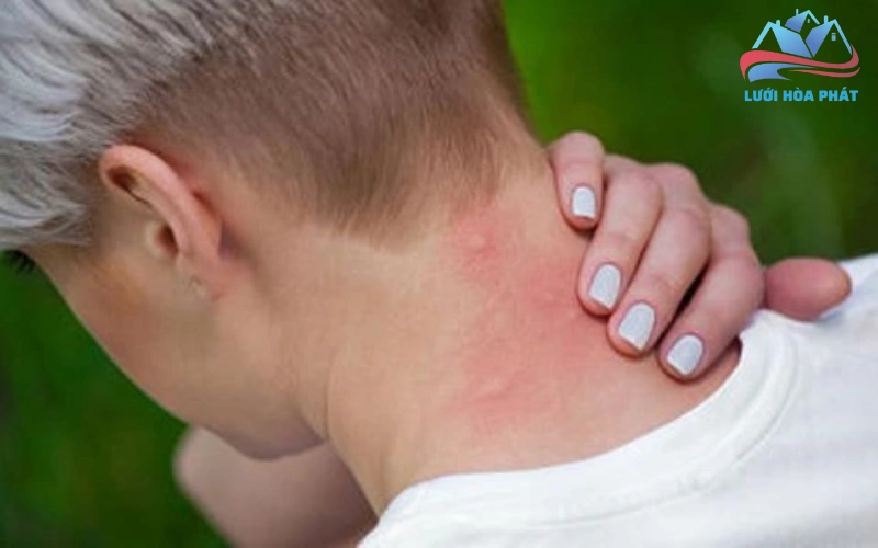 Các chứng bệnh liên quan khác